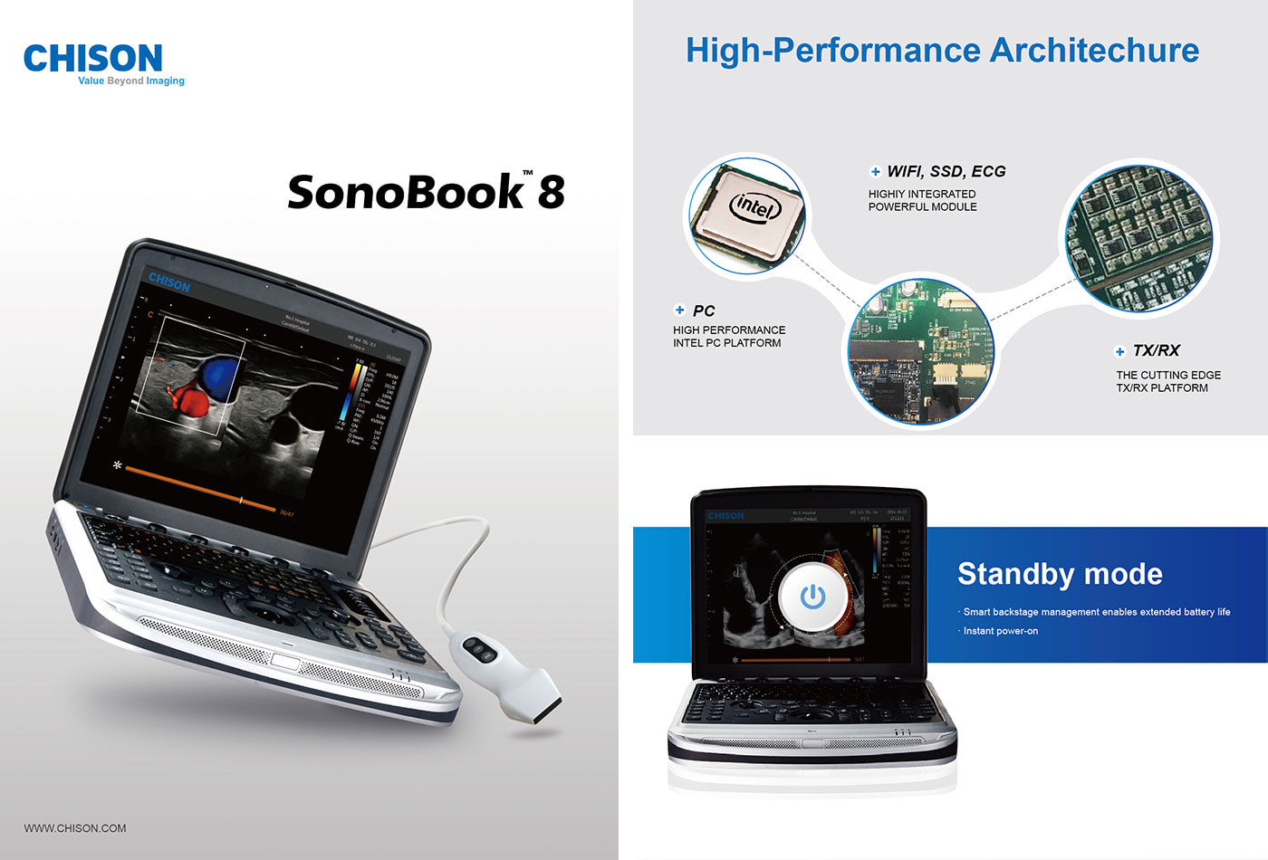 Мобильный УЗИ аппарат Chison Sonotouch 80 (SonoBook 8) — дополнительное изображение 1