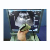 Конвексный датчик УЗИ BK MEDICAL 8801