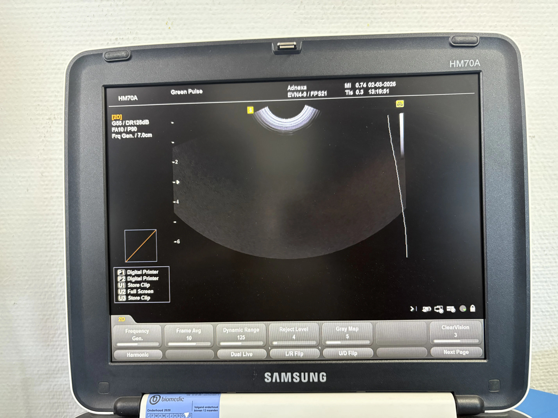 Портативный УЗИ аппарат Samsung Medison HM70A — дополнительное изображение 1