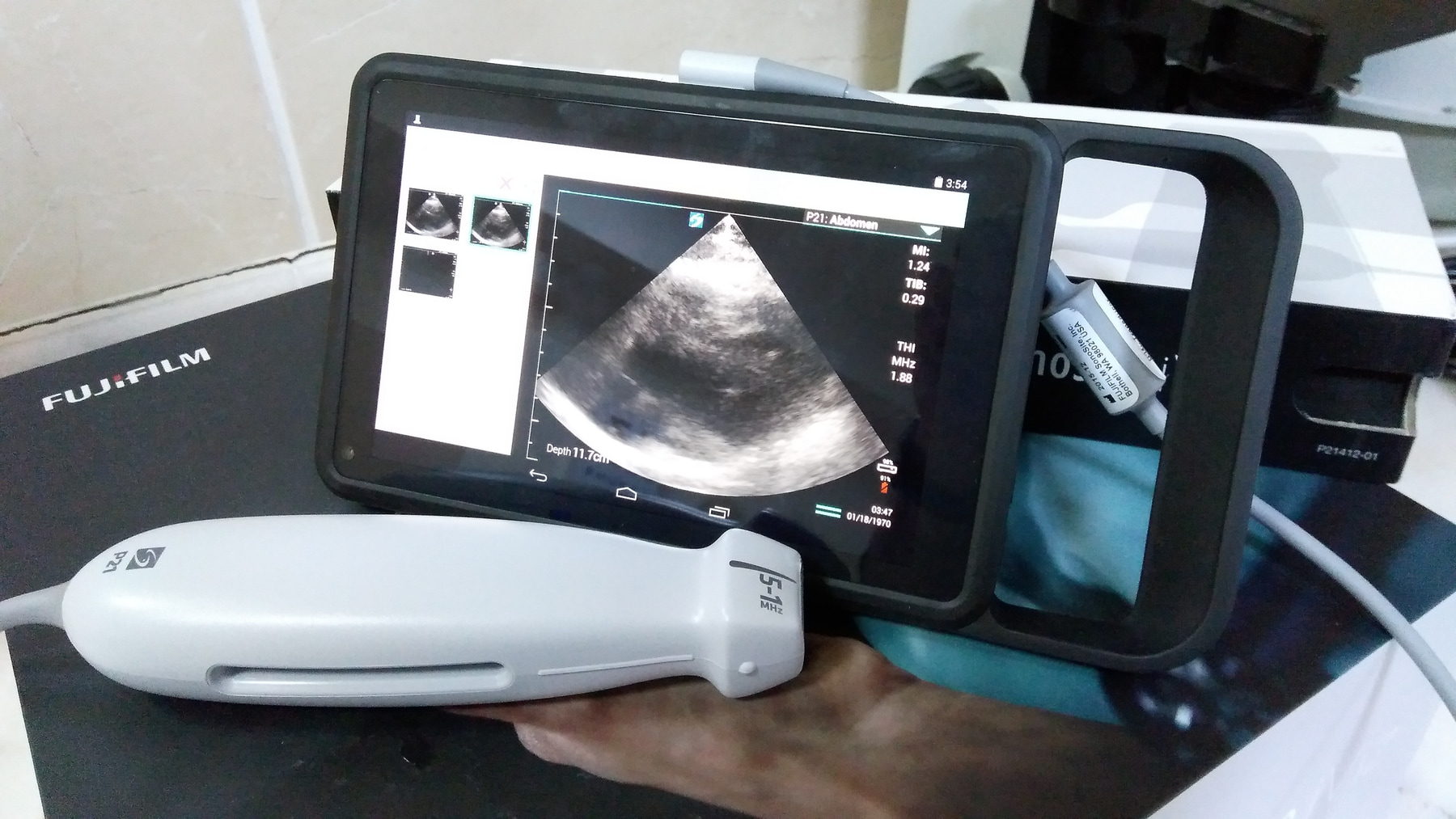 Портативный УЗИ аппарат SONOSITE IVIZ — дополнительное изображение 2