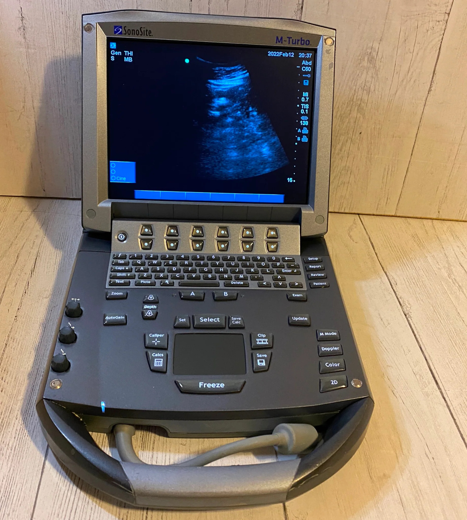 Портативный УЗИ аппарат SONOSITE M-TURBO — дополнительное изображение 2