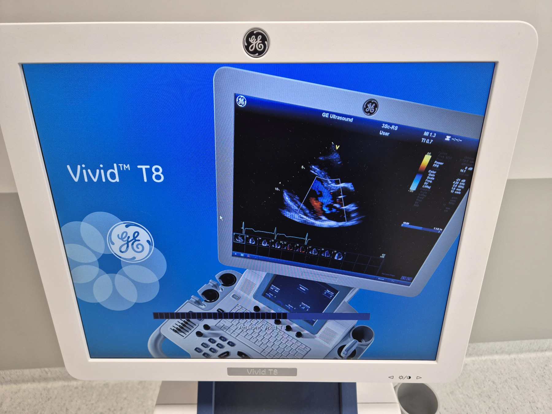 УЗИ аппарат GE Vivid T8 — дополнительное изображение 1