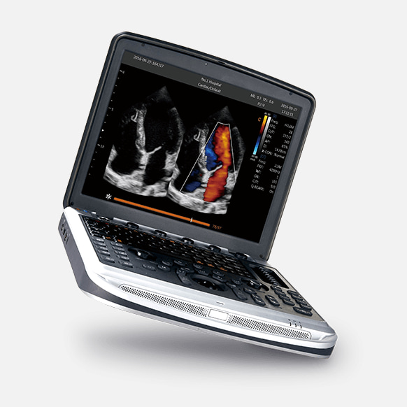 Мобильный УЗИ аппарат Chison Sonotouch 80 (SonoBook 8) — дополнительное изображение 2