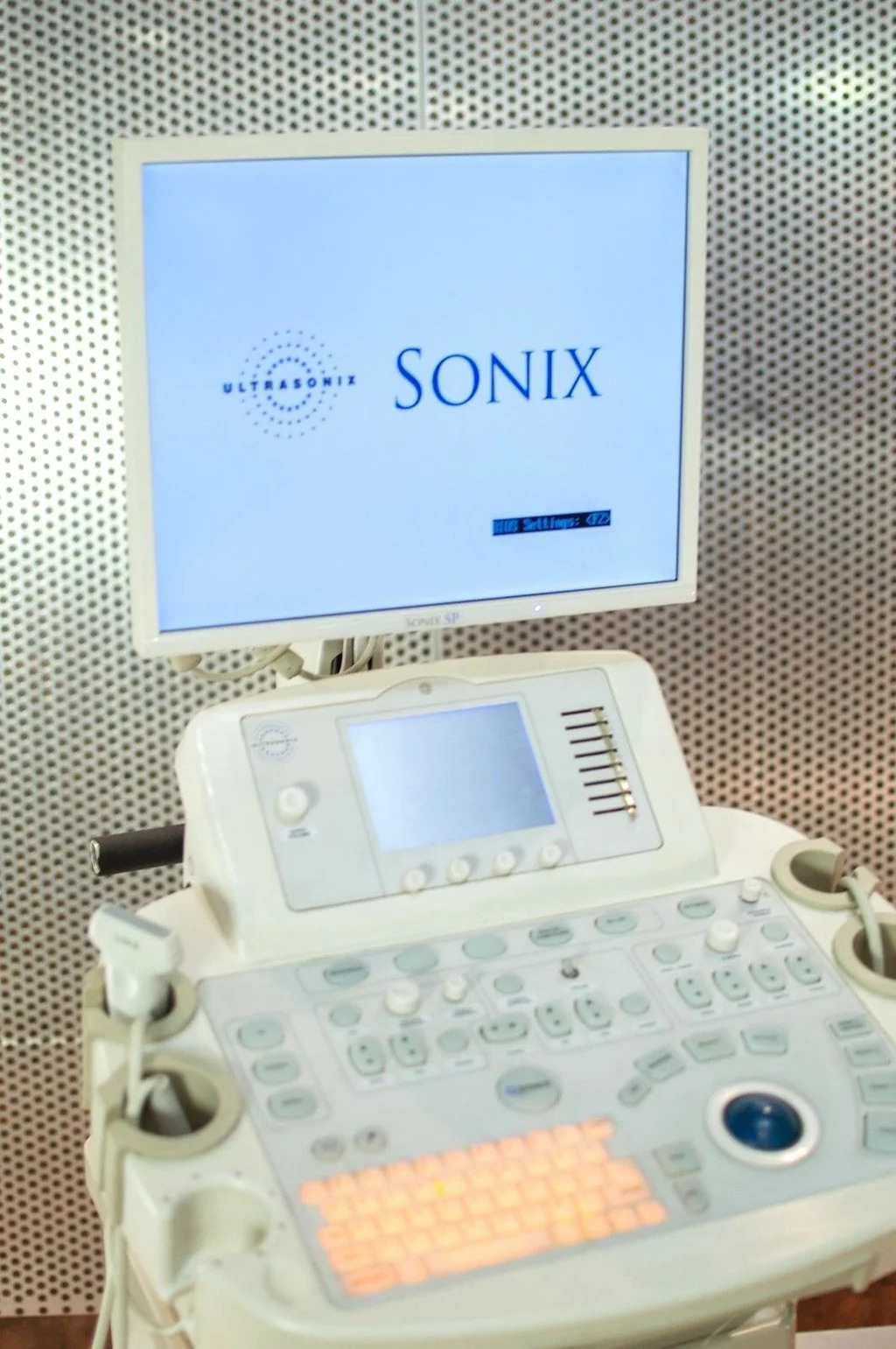 Ультразвуковая система Ultrasonix Sonix SP — дополнительное изображение 1