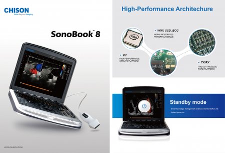 Фото товара: Мобильный УЗИ аппарат Chison Sonotouch 80 (SonoBook 8)