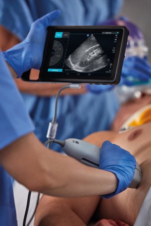 Фото товара: Портативный УЗИ аппарат SONOSITE IVIZ