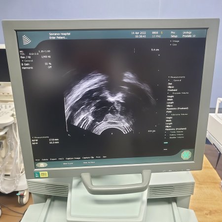 Фото товара: УЗИ аппарат BK Medical Pro Focus UltraView