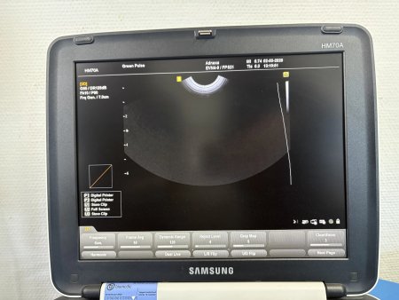 Фото товара: Портативный УЗИ аппарат Samsung Medison HM70A