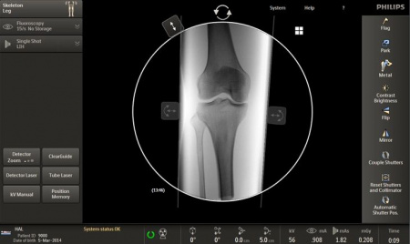 Фото товара: Интервенционная рентгеновская система Philips Veradius Unity