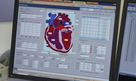 Фото товара: Интервенционная рентгеновская система Philips Xper Flex Cardio