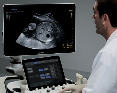 Фото товара: УЗИ аппарат Samsung Medison W10