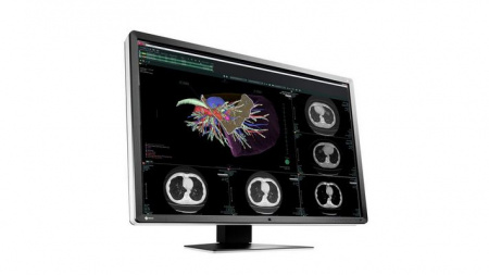 Фото товара: Диагностический дисплей EIZO RadiForce RX660